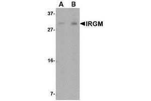 Image no. 1 for anti-Immunity-Related GTPase Family, M (IRGM) (N-Term) antibody (ABIN1494356)