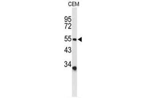 Western Blotting (WB) image for anti-Amiloride-Sensitive Cation Channel 2, Neuronal (ACCN2) (AA 499-528), (C-Term) antibody (ABIN950535)