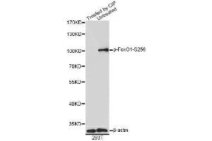 Western blot analysis of extracts of 293T cells, using Phospho-FoxO1-S256 antibody (ABIN5969947) at 1/1000 dilution. (FOXO1 Antikörper  (pSer256))