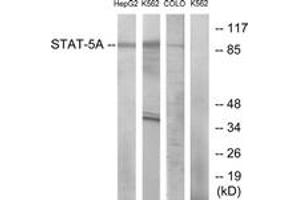 Western Blotting (WB) image for anti-Signal Transducer and Activator of Transcription 5A (STAT5A) (AA 666-715) antibody (ABIN2889069) (STAT5A Antikörper  (AA 666-715))