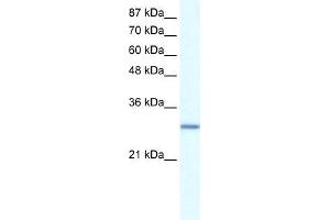 Human Daudi; WB Suggested Anti-GTF2E2 Antibody Titration: 0. (GTF2E2 Antikörper  (N-Term))