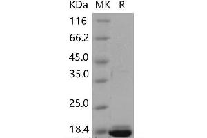 Western Blotting (WB) image for Peroxiredoxin 5 (PRDX5) (Active) protein (His tag) (ABIN7320236)