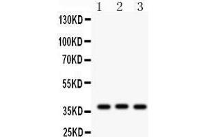 Western Blotting (WB) image for anti-Connective Tissue Growth Factor (CTGF) (AA 58-349) antibody (ABIN3042771) (CTGF Antikörper  (AA 58-349))