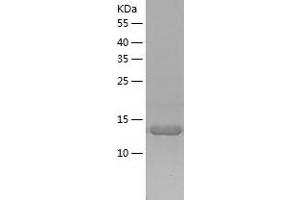 Western Blotting (WB) image for Bromodomain Adjacent To Zinc Finger Domain, 1A (BAZ1A) (AA 1415-1545) protein (His tag) (ABIN7122039) (BAZ1A Protein (AA 1415-1545) (His tag))
