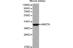 Western blot analysis of extracts of mouse kidney, using WNT7A antibody (ABIN5973149).