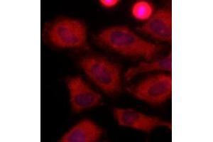 Immunofluorescenitrocellulosee of human HeLa cells stained with Hoechst 3342 (Blue) for nucleus staining and monoclonal anti-human LDHA antibody (1:500) with Texas Red (Red). (Lactate Dehydrogenase A Antikörper  (AA 1-332))