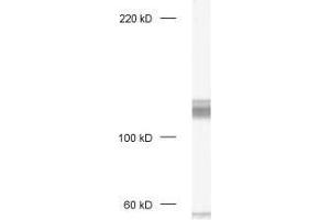 dilution: 1 : 1000, sample: crude synaptosomal fraction of rat brain (P2) (DLG1 Antikörper)