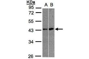 WB Image Sample(30 ug whole cell lysate) A:A431, B:Raji , 10% SDS PAGE antibody diluted at 1:1000 (MBNL3 Antikörper)