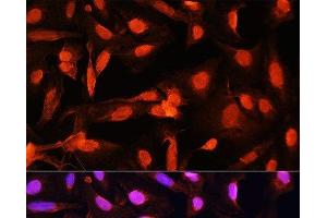 Immunofluorescence analysis of U20S cells using SGOL1 Polyclonal Antibody at dilution of 1:100. (Shugoshin Antikörper)