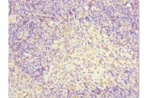 Immunohistochemistry of paraffin-embedded human thymus tissue using ABIN7143883 at dilution of 1:100 (TFCP2 Antikörper  (AA 1-280))