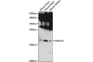 Western blot analysis of extracts of various cell lines, using RA antibody (ABIN7269801) at 1:1000 dilution. (RAB22A Antikörper  (AA 1-100))