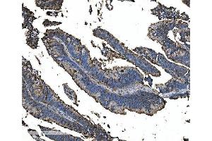 IHC analysis of Astrin/Deepest/SPAG5 using anti-Astrin/Deepest/SPAG5 antibody (ABIN7602399). (SPAG5 Antikörper  (AA 738-1193))