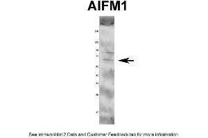 WB Suggested Anti-AIFM1 Antibody Titration: 1 ug/mlPositive Control: Rat tissue (AIF Antikörper  (Middle Region))