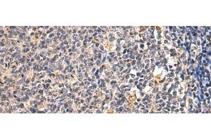 Immunohistochemistry of paraffin-embedded Human tonsil tissue using ENTPD1 Polyclonal Antibody at dilution of 1:60(x200) (CD39 Antikörper)