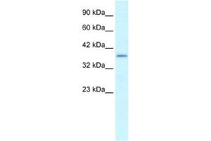 WB Suggested Anti-SOX18 Antibody Titration:  0. (SOX18 Antikörper  (Middle Region))