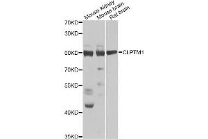 Western blot analysis of extracts of various cell lines, using CLPTM1 Antibody. (CLPTM1 Antikörper)