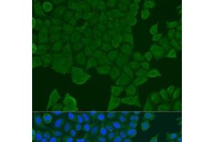 Immunofluorescence analysis of U2OS cells using REEP1 Polyclonal Antibody at dilution of 1:100. (Receptor Accessory Protein 1 Antikörper)