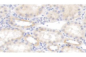 Detection of TNFb in Human Kidney Tissue using Monoclonal Antibody to Tumor Necrosis Factor Beta (TNFb) (LTA Antikörper  (AA 36-205))