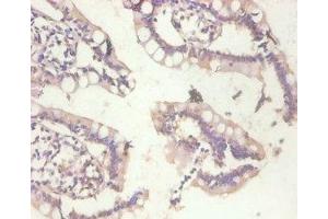 Immunohistochemistry of paraffin-embedded human small intestine tissue using ABIN7159509 at dilution of 1:100 (MT1A Antikörper  (AA 1-59))