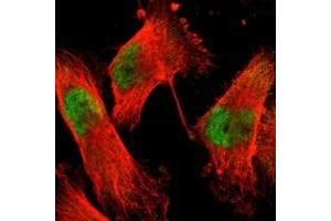 Immunofluorescent staining of human cell line U-251 MG with ACIN1 polyclonal antibody  at 1-4 ug/mL dilution shows positivity in nucleus but not nucleoli. (ACIN1 Antikörper)