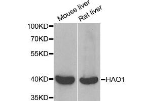 Western blot analysis of extracts of various cell lines, using HAO1 antibody (ABIN5973868) at 1/1000 dilution. (HAO1 Antikörper)