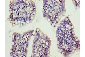 Immunohistochemistry of paraffin-embedded human small intestine tissue using ABIN7175892 at dilution of 1:100 (XRRA1 Antikörper  (AA 101-400))