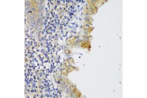 Immunohistochemistry of paraffin-embedded human appendix using GCC2 antibody (ABIN6130422, ABIN6141007, ABIN6141008 and ABIN6217941) at dilution of 1:150 (40x lens). (GCC2 Antikörper  (AA 1-300))