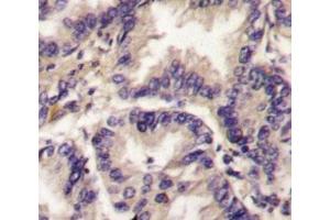 Immunohistochemistry (IHC) image for anti-Vascular Endothelial Growth Factor C (VEGFC) (AA 248-277) antibody (ABIN3029583)