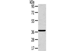 Gel: 8 % SDS-PAGE,Lysate: 40 μg,Primary antibody: ABIN7192440(SLC25A20 Antibody) at dilution 1/200 dilution,Secondary antibody: Goat anti rabbit IgG at 1/8000 dilution,Exposure time: 1 minute (SLC25A2 Antikörper)