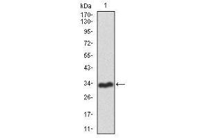 Image no. 1 for anti-Recombination Activating Gene 1 (RAG1) antibody (ABIN1491682) (RAG1 Antikörper)