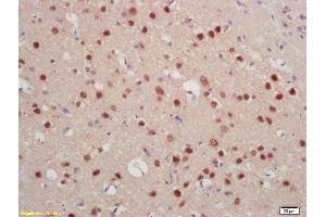 Formalin-fixed and paraffin embedded rat brain labeled with Rabbit Anti Jarid2/Jumonji Polyclonal Antibody, Unconjugated (ABIN1386206) at 1:200 followed by conjugation to the secondary antibody and DAB staining (JARID2 Antikörper  (AA 301-400))