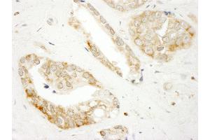 anti-Dedicator of Cytokinesis 4 (DOCK4) (AA 1725-1775) antibody