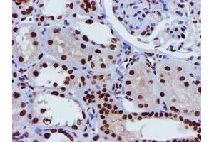 Image no. 3 for anti-Glutathione S-Transferase theta 2 (GSTT2) antibody (ABIN1498553) (GSTT2 Antikörper)