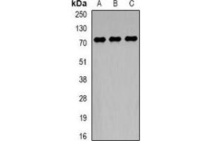 Western blot analysis of TCF4 expression in HepG2 (A), MCF7 (B), mouse brain (C) whole cell lysates. (TCF4 Antikörper)