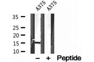 Western blot analysis of extracts of A375 cells, using FABP5 antibody. (FABP5 Antikörper  (Internal Region))