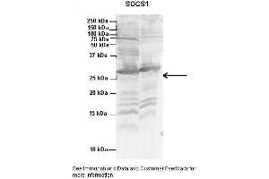 Western Blotting (WB) image for anti-Suppressor of Cytokine Signaling 1 (SOCS1) (N-Term) antibody (ABIN2777164)