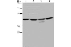 Western Blot analysis of K562 and 293T cell, Jurkat cell and Mouse brain tissue using CSNK2A1 Polyclonal Antibody at dilution of 1:300 (CSNK2A1/CK II alpha Antikörper)