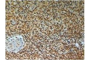 Immunohistochemistry (Paraffin-embedded Sections) (IHC (p)) image for anti-TRAF Interacting Protein (TRAIP) (C-Term) antibody (ABIN783910)