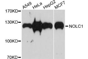 Western blot analysis of extracts of various cell lines, using NOLC1 antibody. (NOLC1 Antikörper)