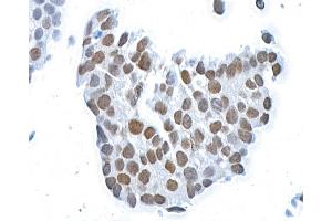 Immunocytochemistry (ICC) image for anti-BMI1 Polycomb Ring Finger Oncogene (BMI1) (AA 250-300) antibody (ABIN7455106) (Rekombinanter BMI1 Antikörper  (AA 250-300))