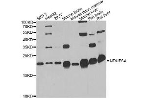 Western blot analysis of extracts of various cell lines, using NDUFS4 antibody. (NDUFS4 Antikörper)