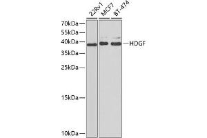 Western blot analysis of extracts of various cell lines, using HDGF antibody  at 1:1000 dilution. (HDGF Antikörper  (AA 1-240))