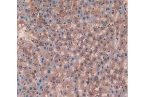 Used in DAB staining on fromalin fixed paraffin- embedded liver tissue (Laminin beta 3 Antikörper  (AA 503-738))
