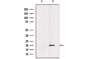 Western blot analysis of extracts from 293, using BTC Antibody.