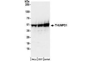 anti-THUMP Domain Containing 1 (THUMPD1) (AA 303-353) antibody