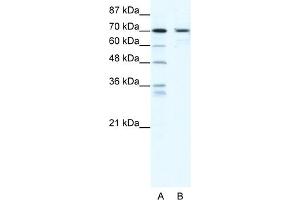 WB Suggested Anti-PRDM1 Antibody Titration:  2. (PRDM1 Antikörper  (N-Term))