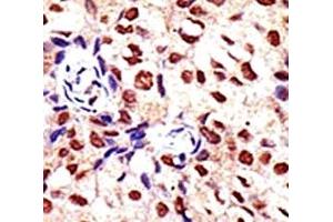 Immunohistochemistry (IHC) image for anti-Protein Arginine Methyltransferase 2 (PRMT2) (AA 22-53) antibody (ABIN3032356)