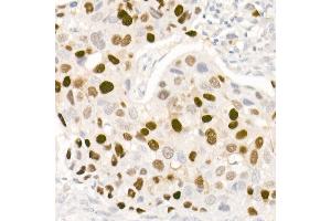 Immunohistochemistry (IHC) image for anti-Progesterone Receptor (PGR) antibody (ABIN7269533)