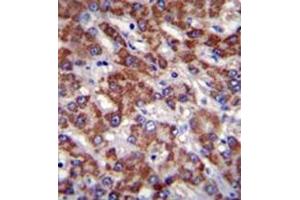 Immunohistochemistry analysis in formalin fixed and paraffin embedded human liver tissue reacted with OR2B11 Antibody (C-term) followed which was peroxidase conjugated to the secondary antibody and followed by DAB staining. (OR2B11 Antikörper  (C-Term))