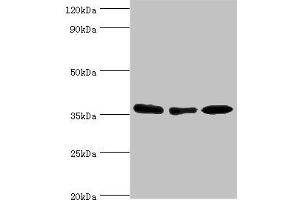 Western blot All lanes: MDH1 antibody at 4 μg/mL Lane 1: HepG2 whole cell lysate Lane 2: Hela whole cell lysate Lane 3: Mouse kidney tissue Secondary Goat polyclonal to rabbit IgG at 1/10000 dilution Predicted band size: 37, 28, 39 kDa Observed band size: 37 kDa (MDH1 Antikörper  (AA 1-334))